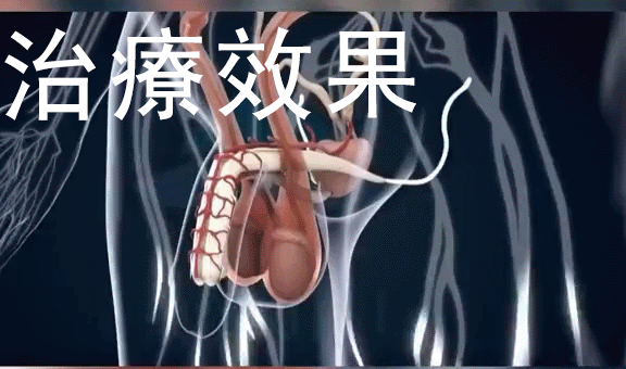 f00ea99d-871e-49ce-a88c-678153467ebf.gif